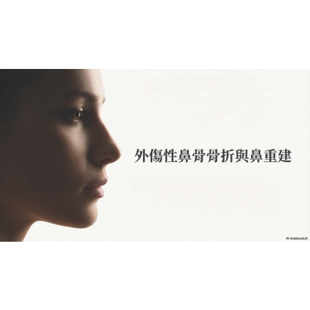 鼻骨骨折全修復