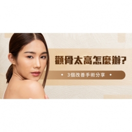 顴骨太高怎麼辦？3種改善顴骨突出手術分享！