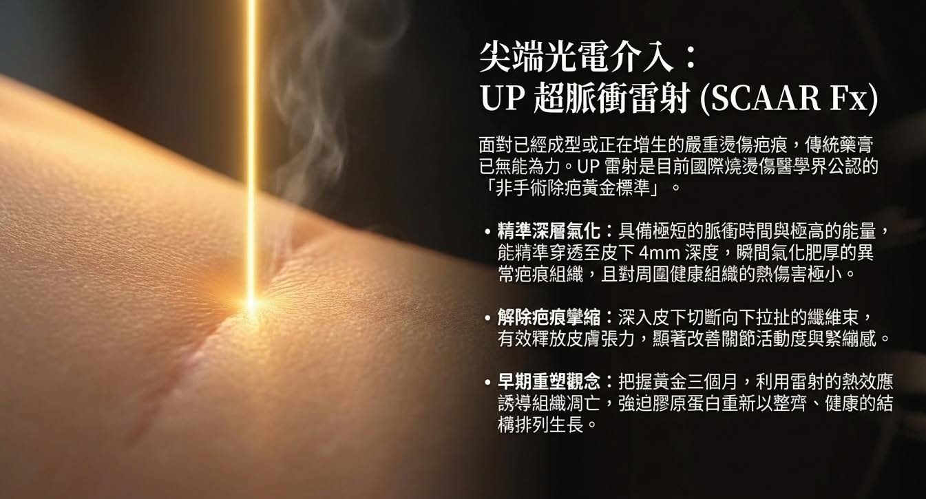 UP超脈衝雷射光電介入治療燙傷疤痕