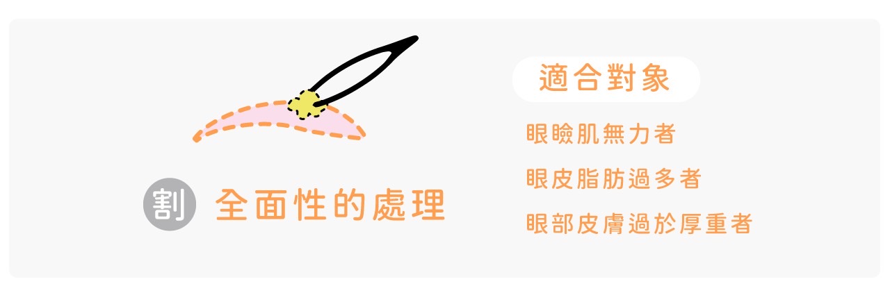 割雙眼皮_適合對象