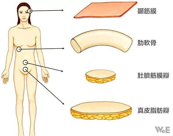 肚臍筋膜瓣的應用