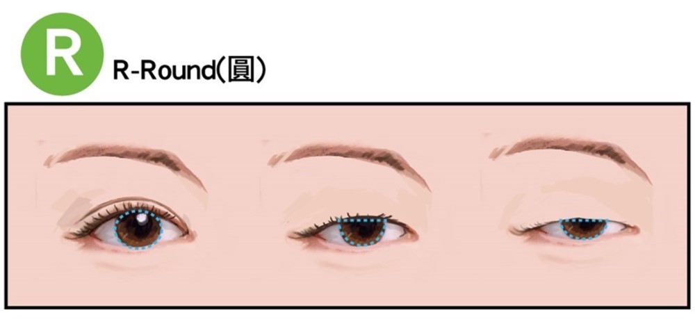 眼頭角度