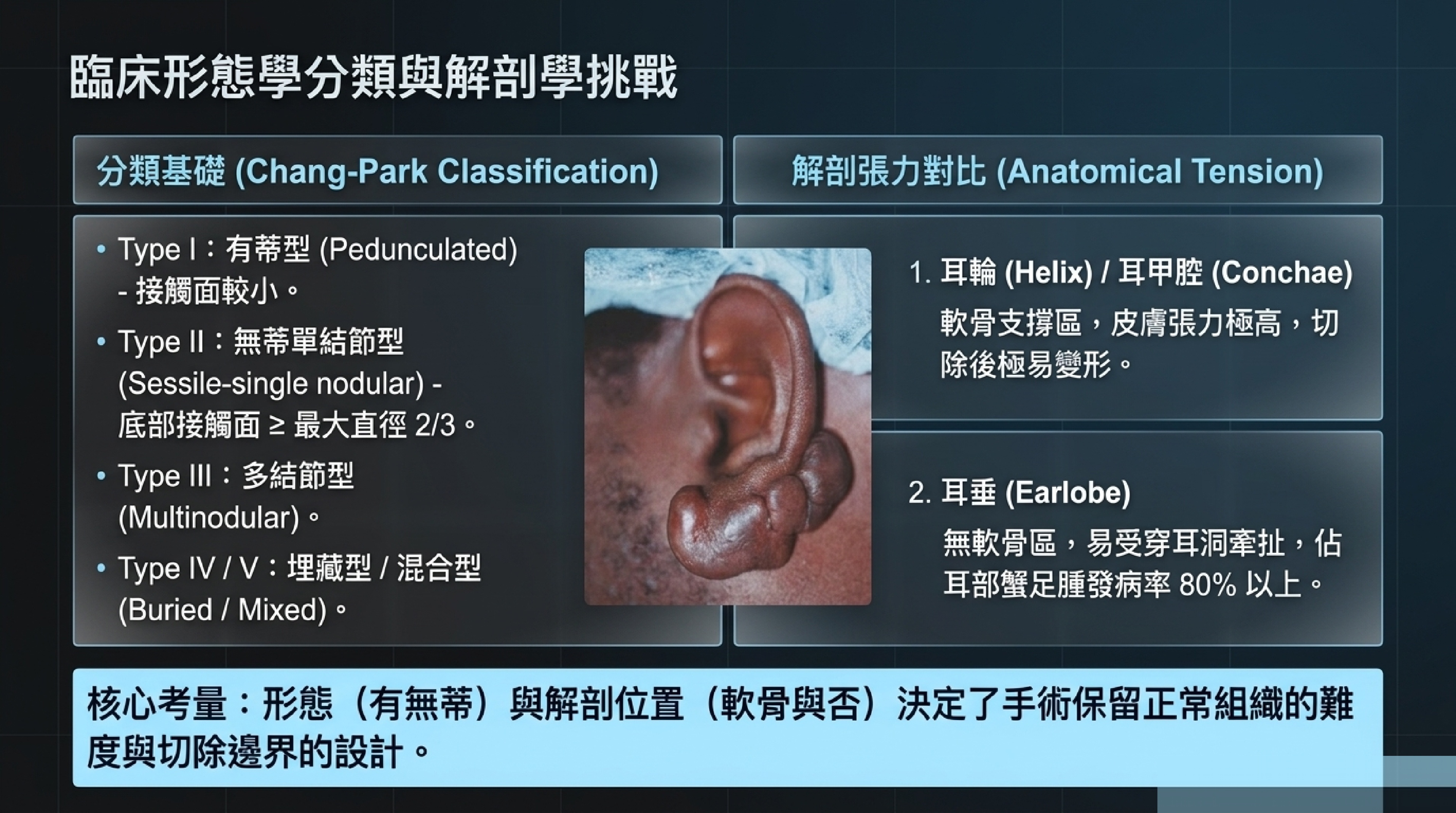 耳朵蟹足腫 Chang-Park 分類與解剖張力對比：耳輪、耳甲腔、耳垂