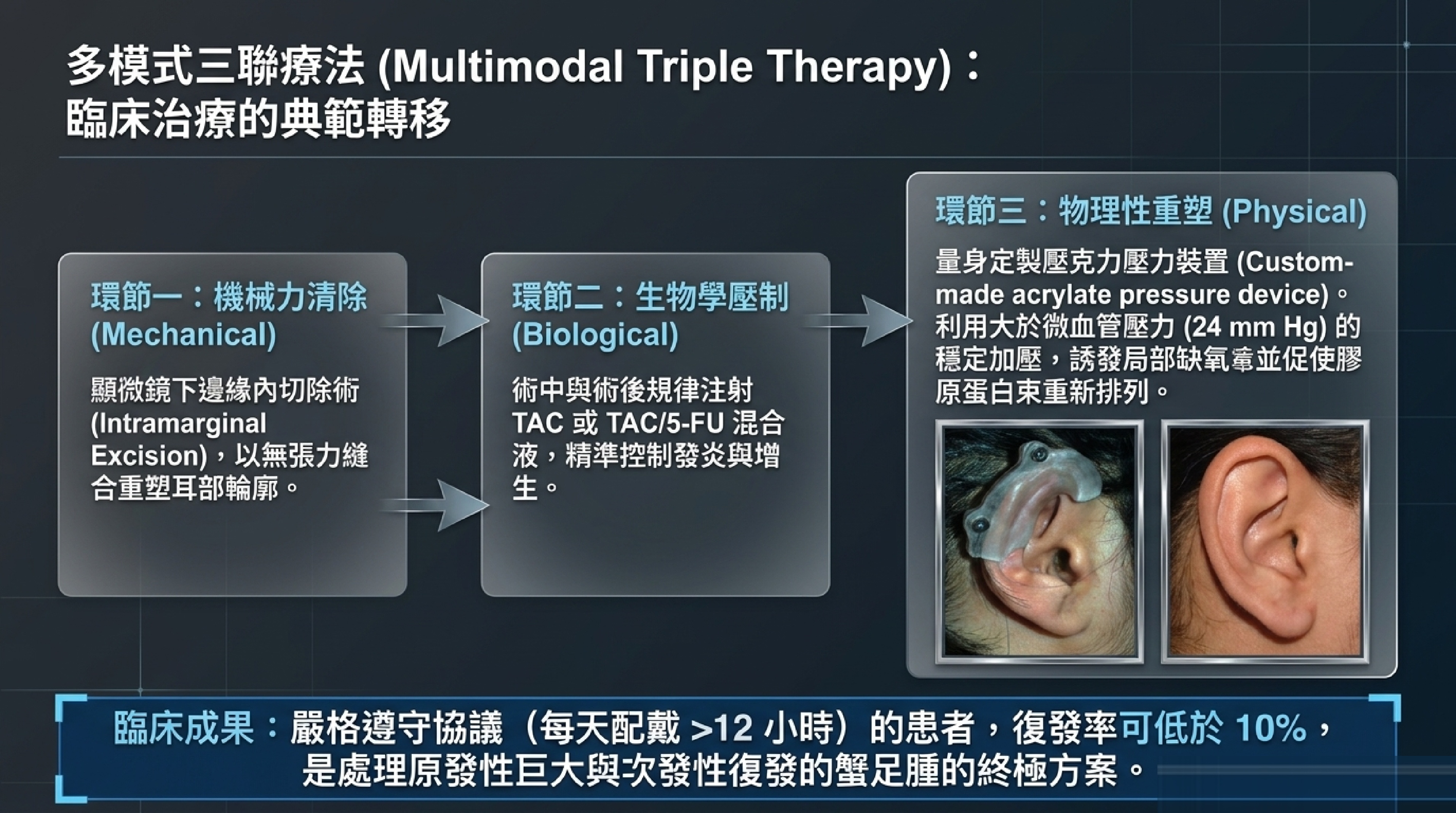 耳朵蟹足腫多模式三聯療法：機械力清除、生物學壓制、物理性重塑