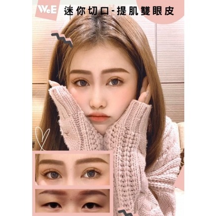 迷你切口_提眼瞼肌
