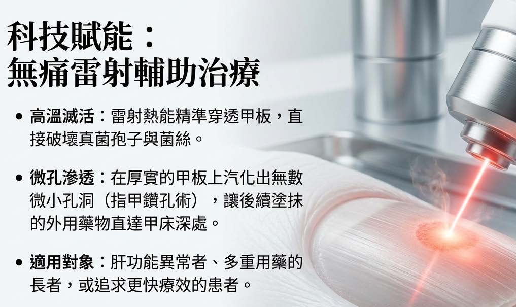 無痛雷射治療技術